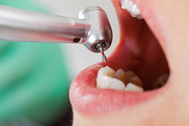 Best Emergency Dentist for Knocked-Out Tooth in Castle Shannon, PA